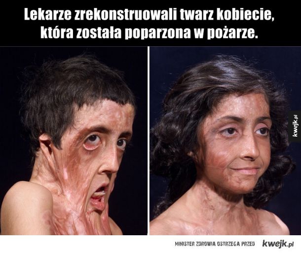 Lekarze zrekonstruowali twarz kobiecie