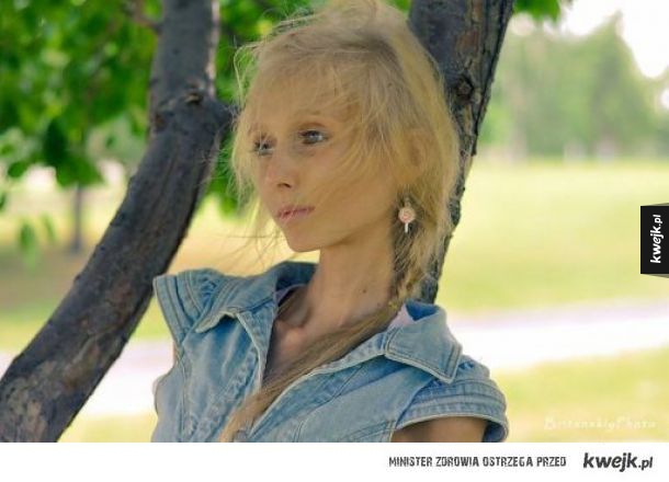 Ksenia Bubenko - chodzący przykład anoreksji