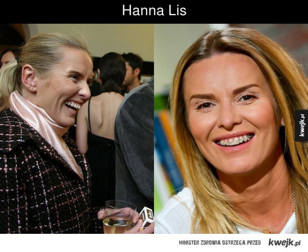 Hanna Lis
