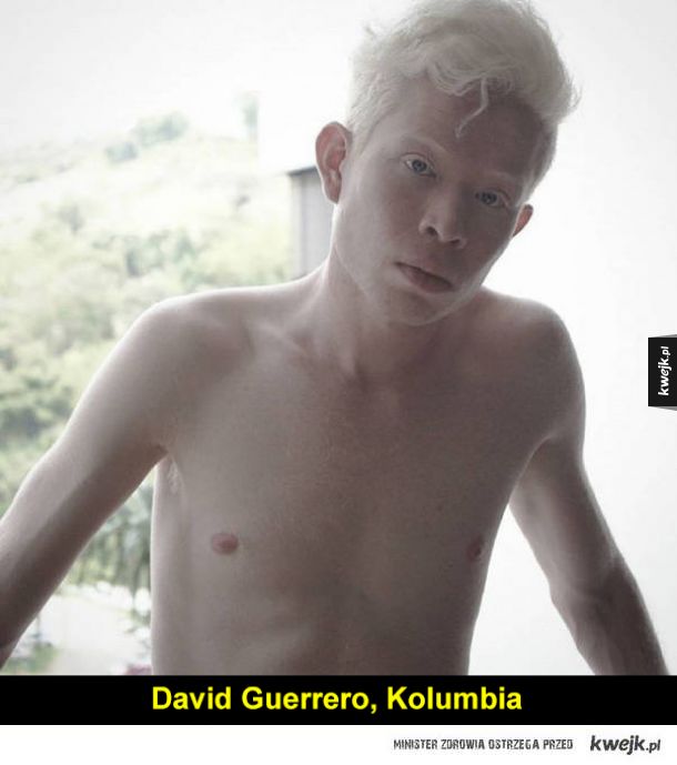 Albinosi z różnych części świata