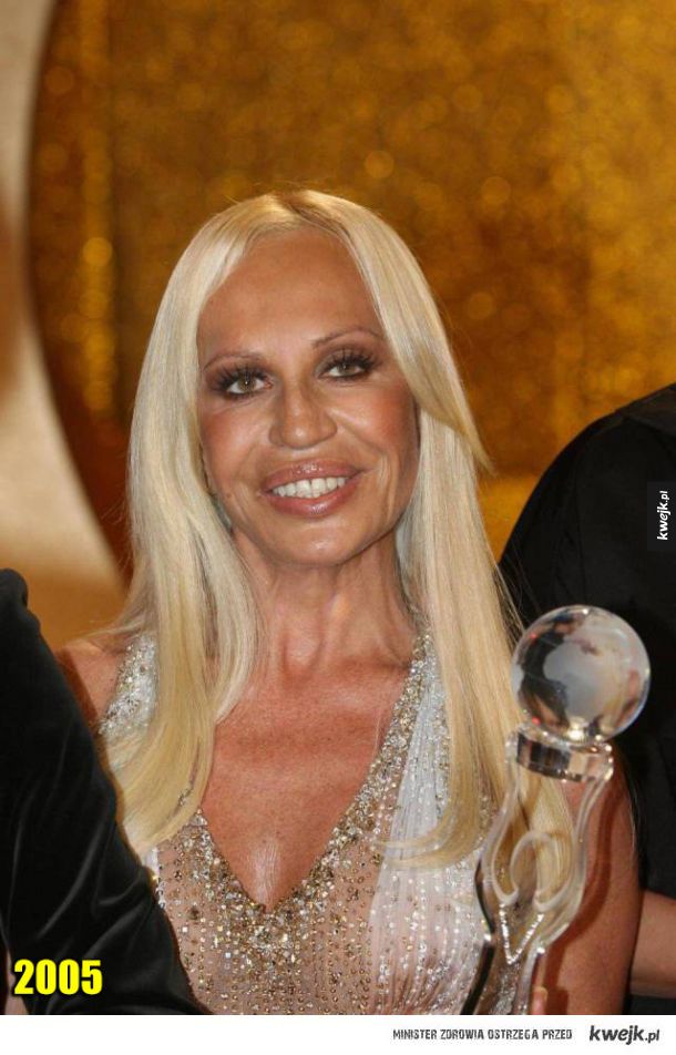 Jak Donatella Versace zmieniała się ze zwykłej kobiety w antyreklamę chirurgii plastycznej