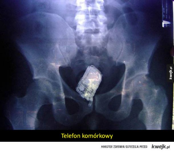 Zdjęcia rentgenowskie, które sprawią, że poczujecie się nieswojo