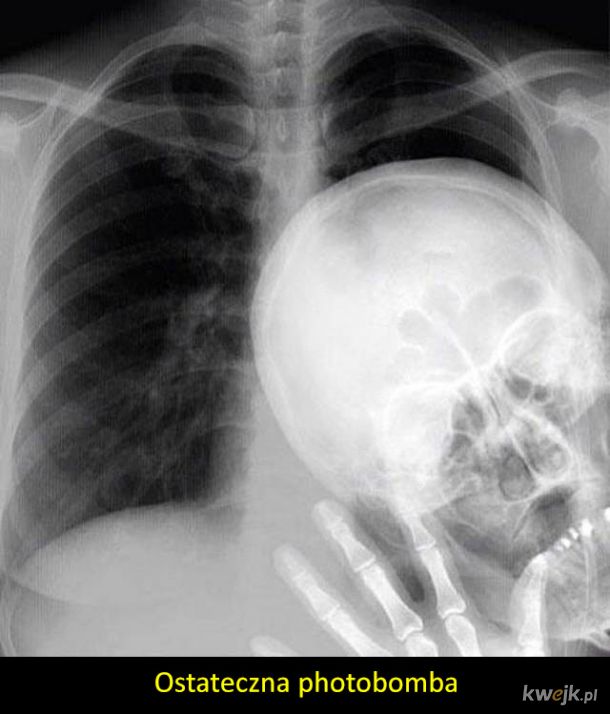Ciekawe zdjęcia rentgenowskie