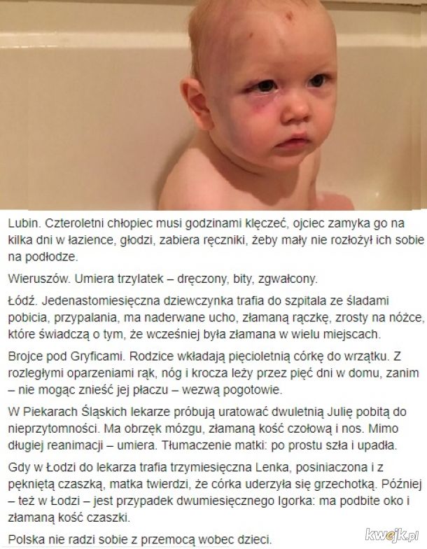 "Tak wygląda pobite dziecko", czyli Polska współcześnie