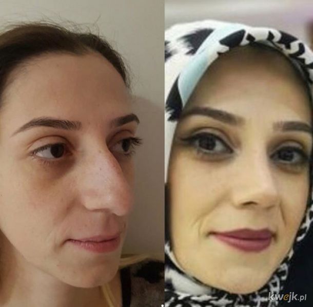 Kobiety, które zmieniły jeden szczegół w swoim wyglądzie - zobacz transformacje, obrazek 15