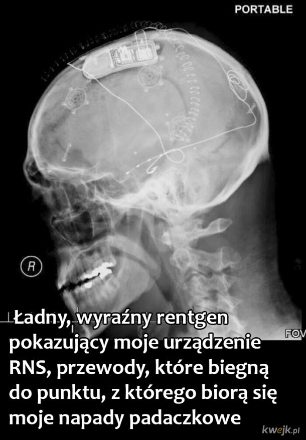 Ciekawe zdjęcia rentgenowskie, obrazek 13