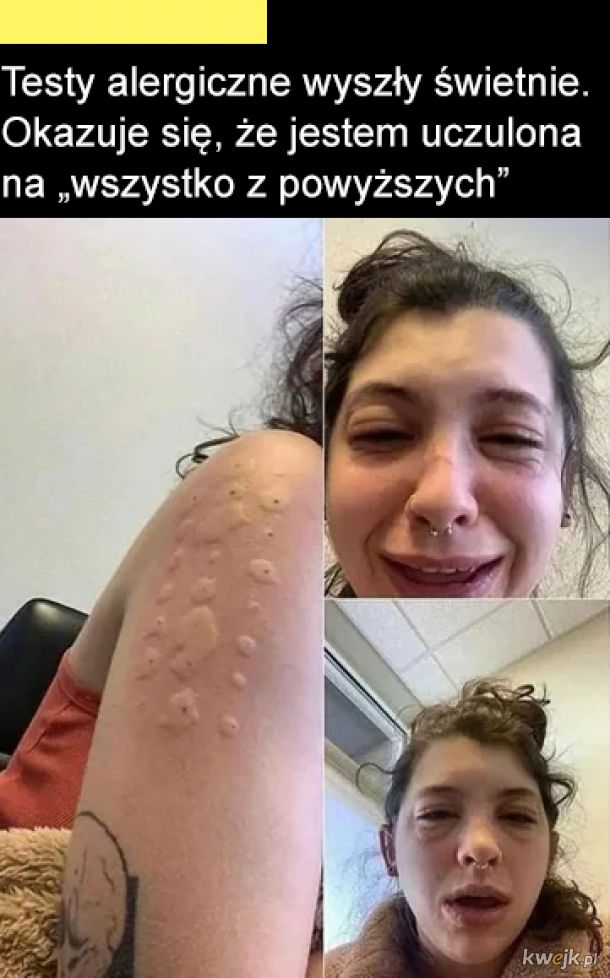Testy alergiczne