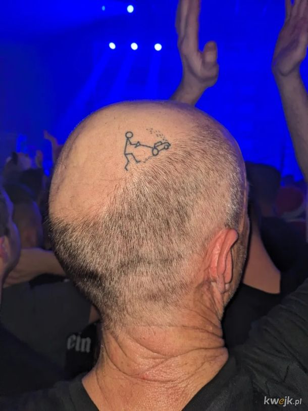 Gdy już masz łysinę, zrób tatuaż!