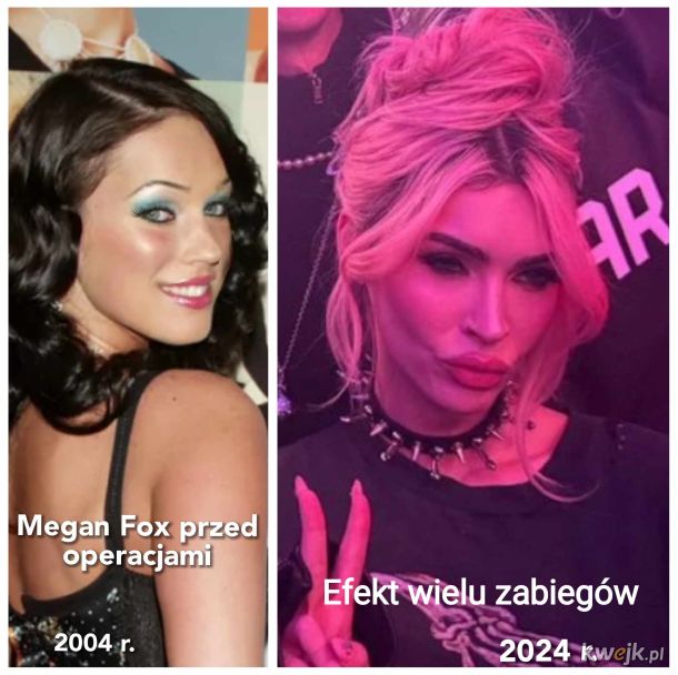Megan Fox - ofiara operacji plastycznych